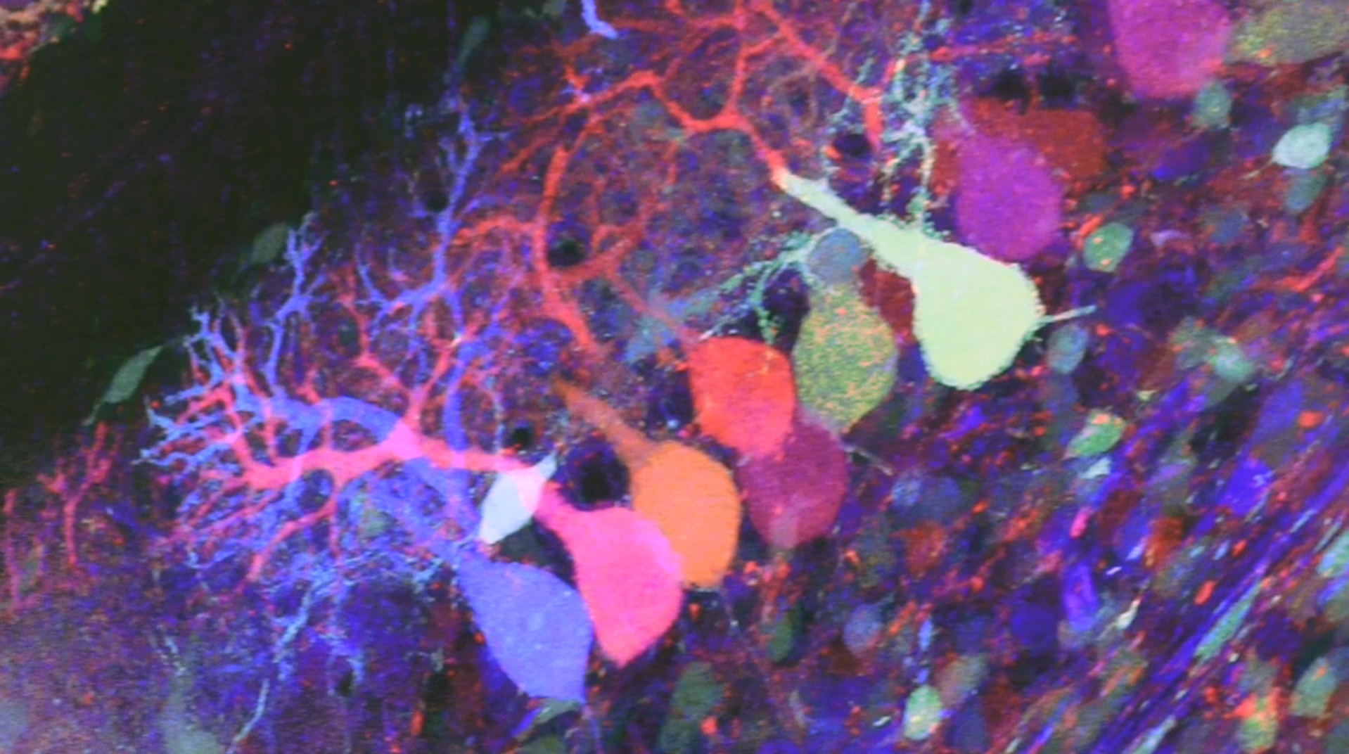 Mapping Neuronal Circuitry using Brainbow zebrafish